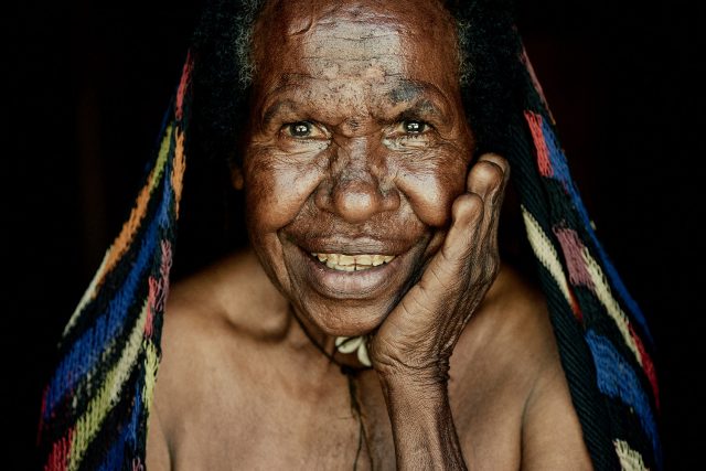 The Dani Woman And The Old Practice Of Finger Amputation