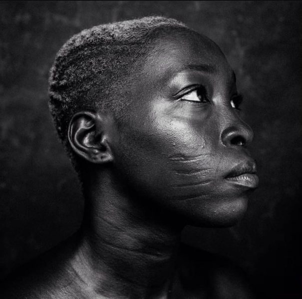 Africa And Scars