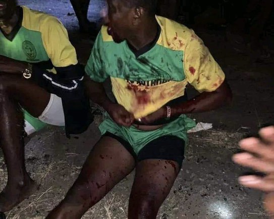 Sad One As Head Coach Dies And Players Sustain Injuries In A Ghastly Accident