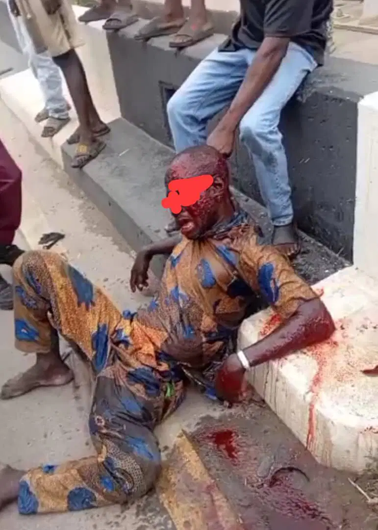 LASTMA Apprehends Togolese Driver In Speed-Induced Crash